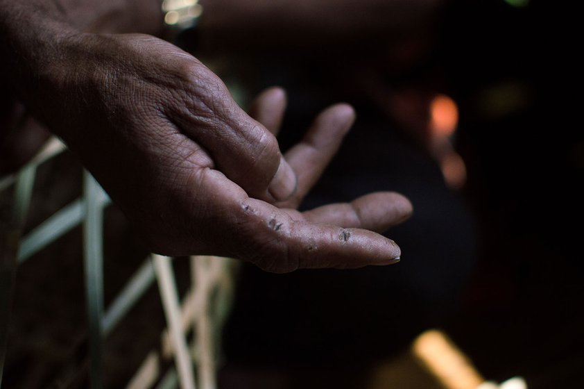 He points out where his fingers have marks from his years of weaving