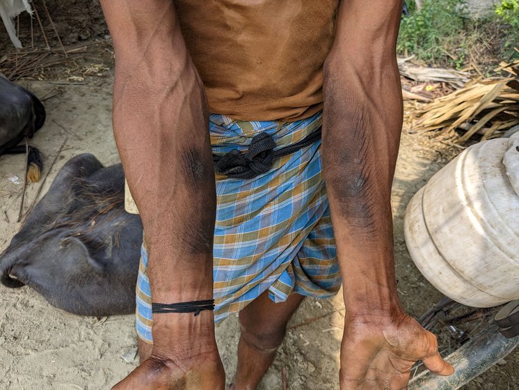 Years of climbing the rugged trunk of palm trees have left dark calluses on his hands and feet