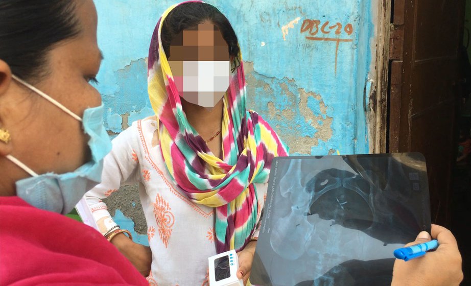 Deepa showing a pelvic region X-ray report to ASHA worker Sushila Devi, which, after months, finally located the copper-T