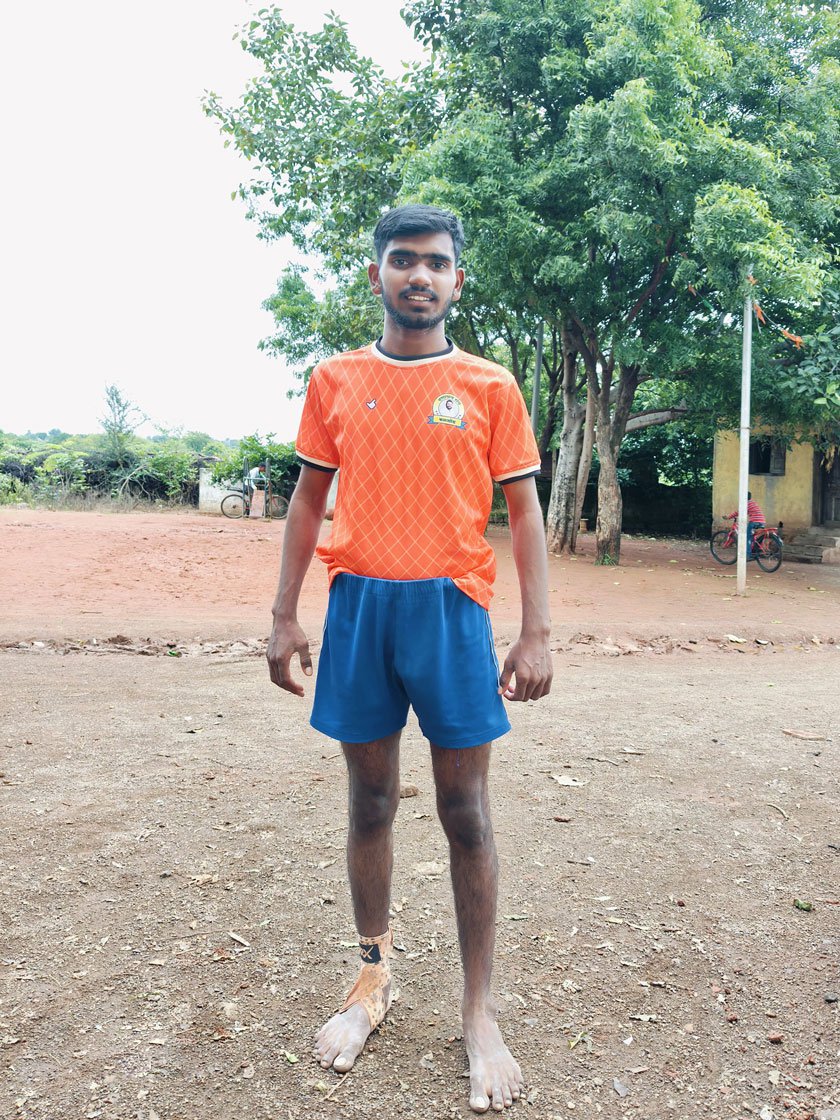 Left: Kabaddi player Pa w an Korde suffered a severe injury to his back during a match. After six months he is finally able to walk and run slowly.