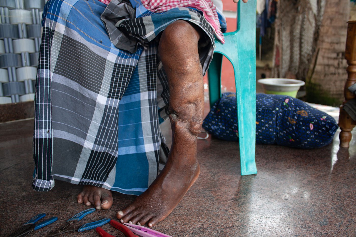 V. Kuppusamy, 67, was shot by the Sri Lankan Navy while he was out fishing on his kattumaram.